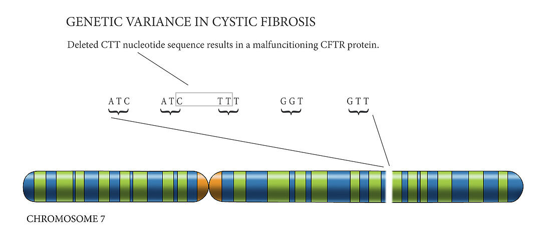 Cystic Fibrosis Chromosome, illustration