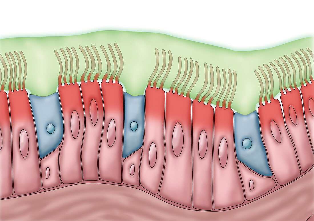 Cilia with Infected Mucus, illustration