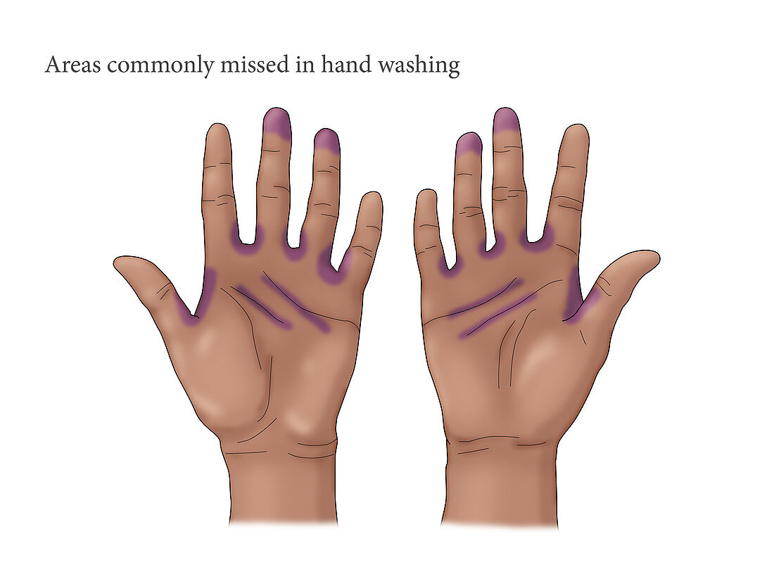 Missed Area in Hand Washing, illustration