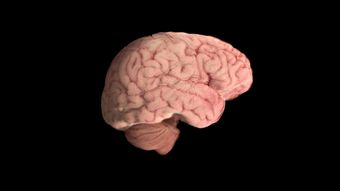 Healthy Brain, Lateral View