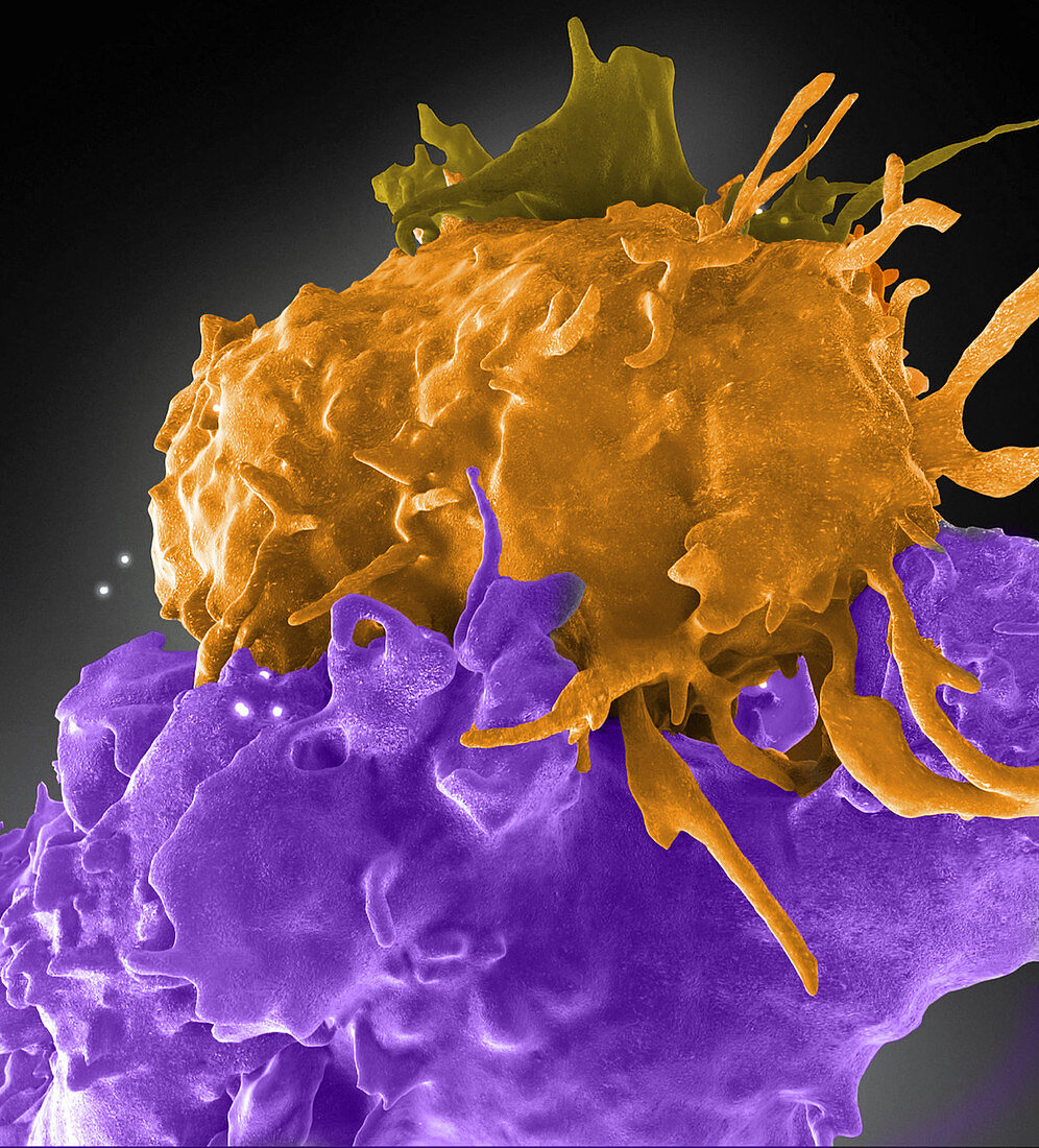 HIV-Infected and Normal T Cells Interact, FIB-SEM