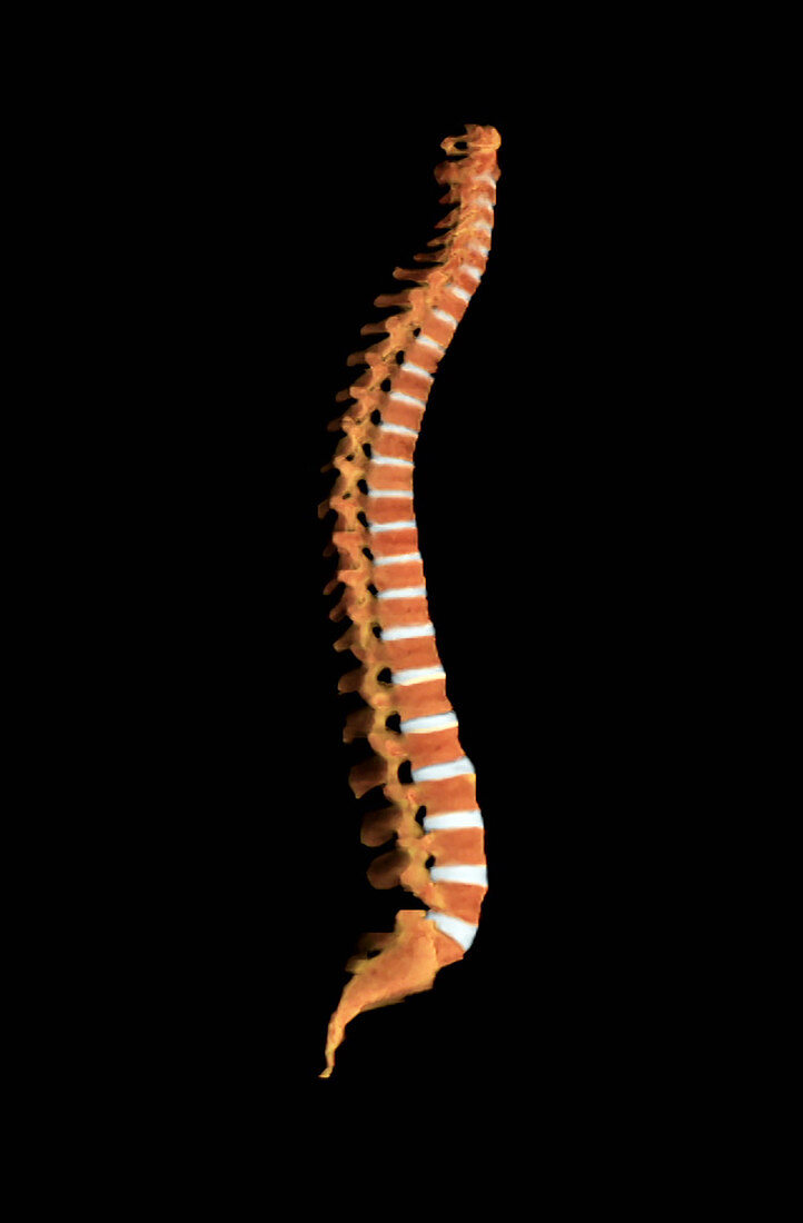 Spinal Column, Lateral View