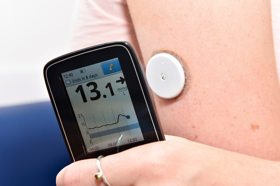 Wireless blood sugar monitor