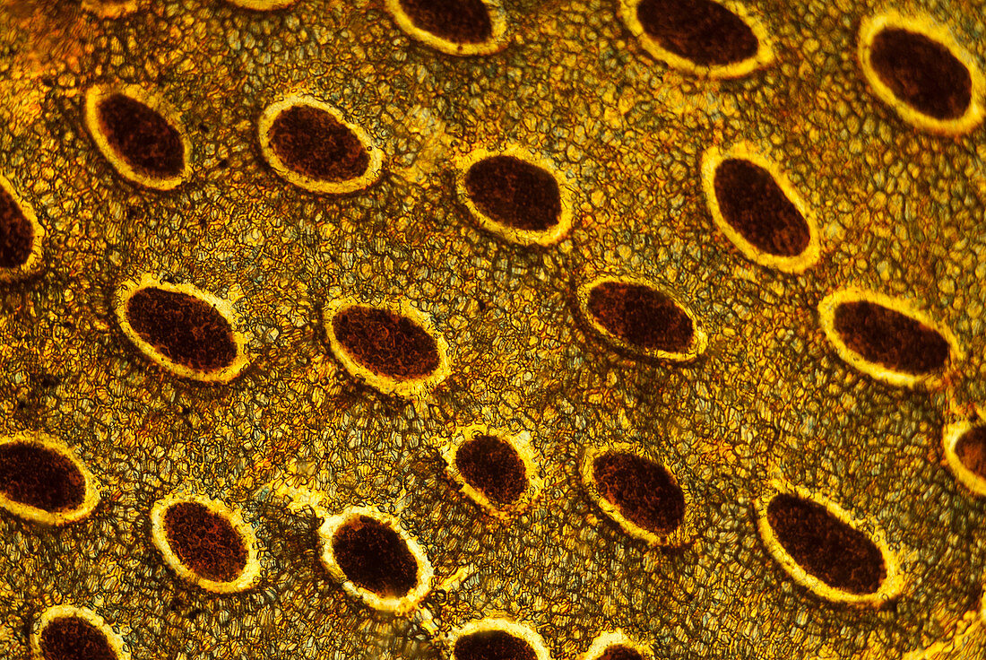 Pitcher plant digestive glands, polarised light micrograph