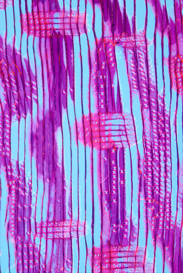 Section of giant redwood, polarised light micrograph