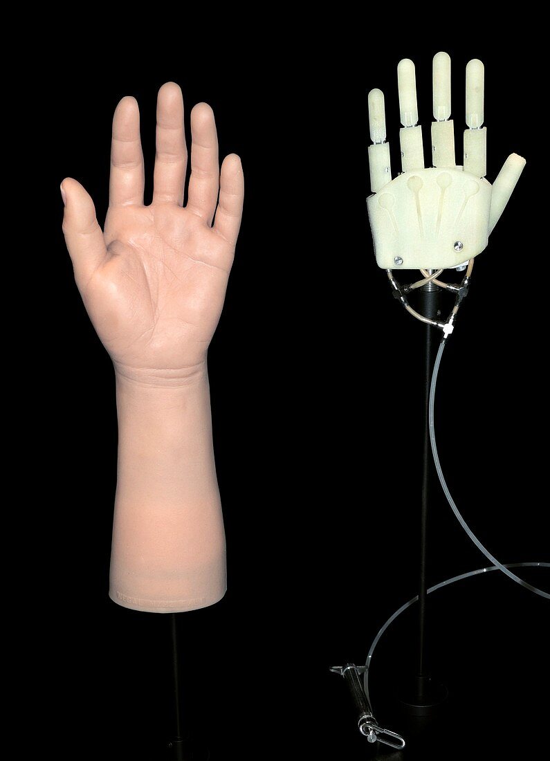 Hand prothesis