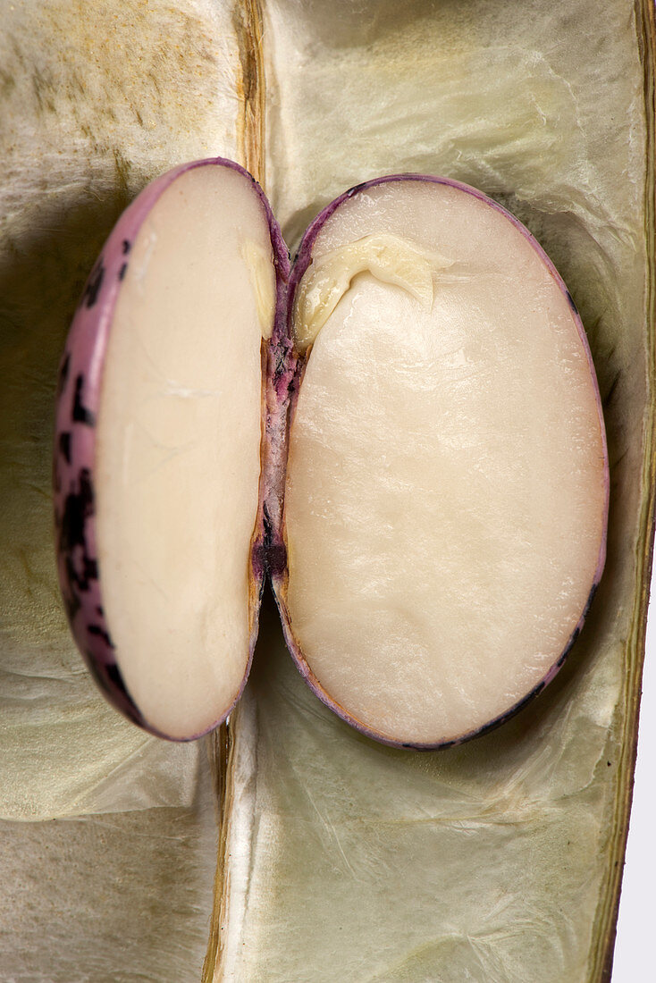 Bean seed embryo