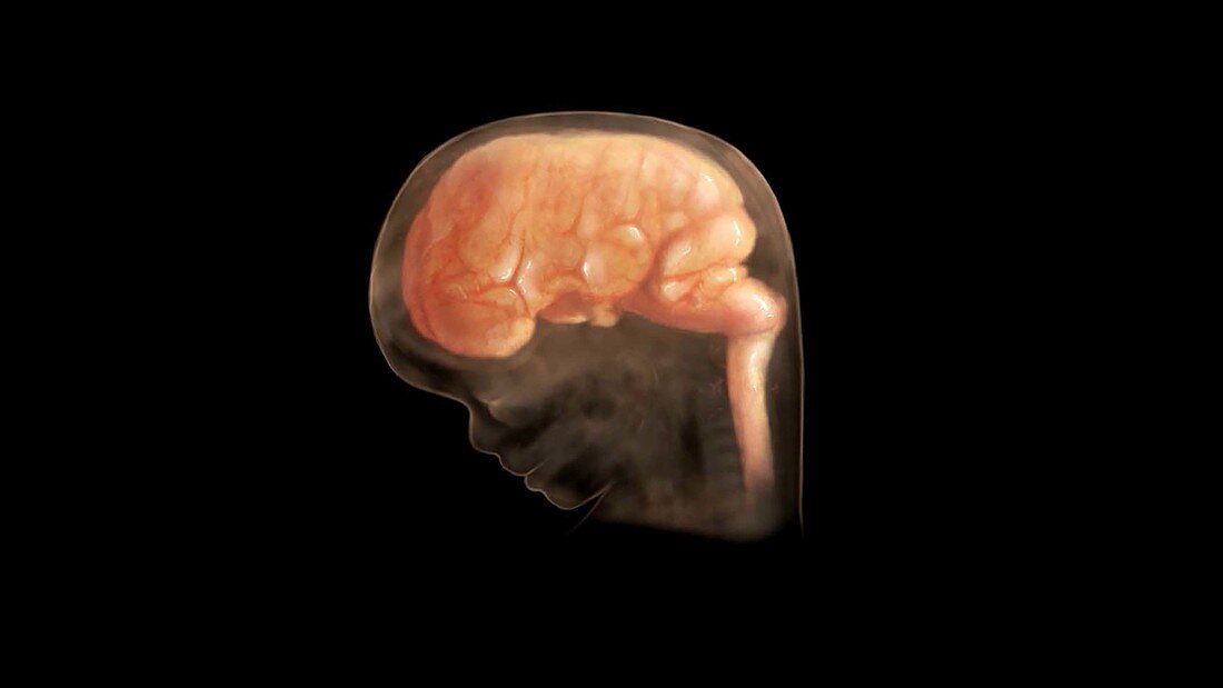 Prenatal Brain Development at 70 Days