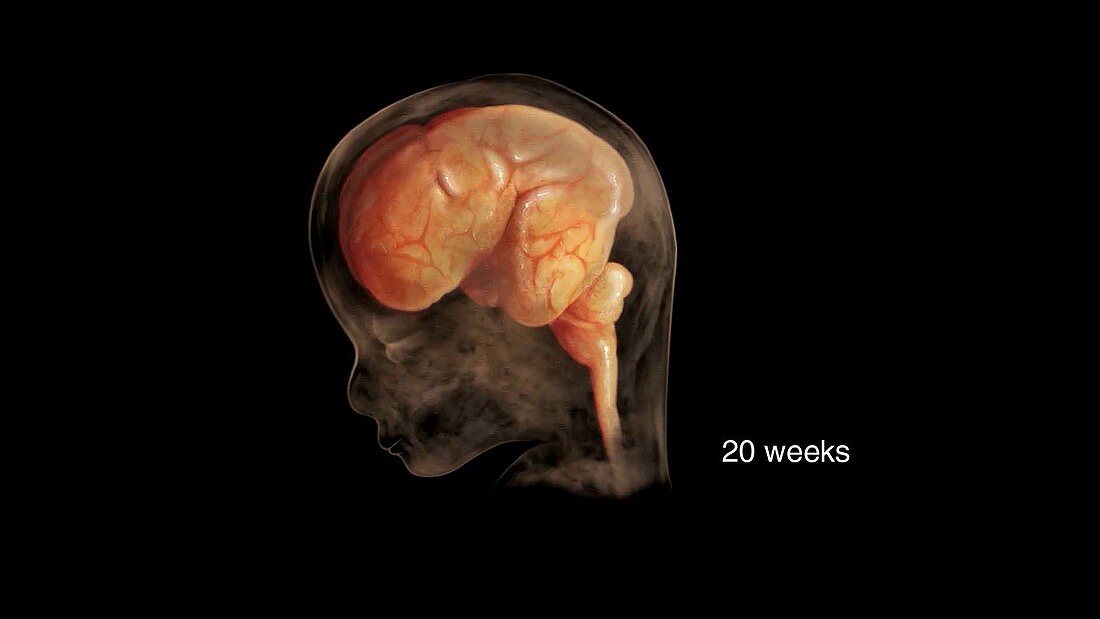 Prenatal Brain Development at 20 Weeks
