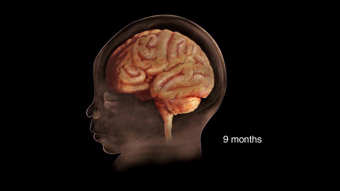 Prenatal Brain Development at 9 Months