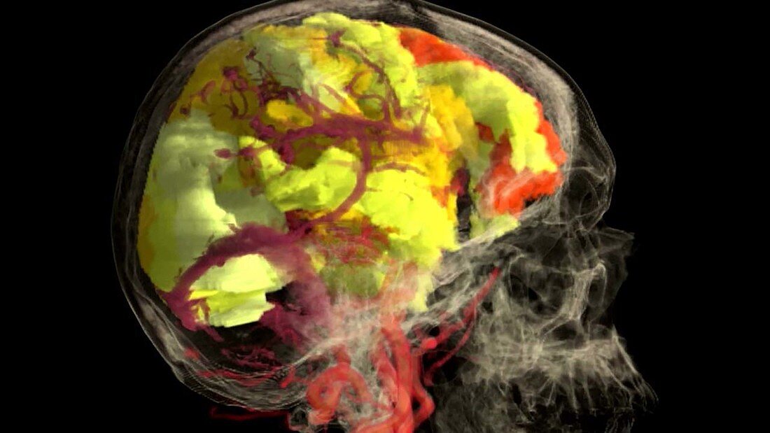 Orgasm Climax, fMRI