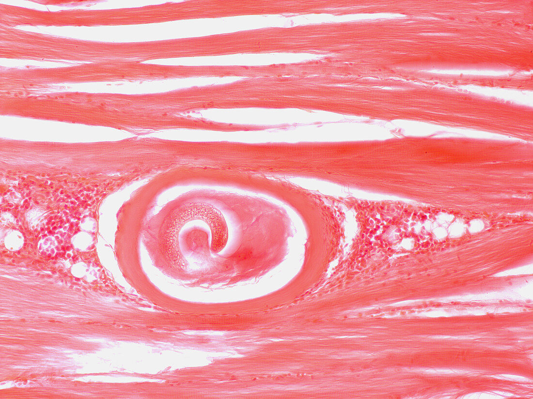 Trichinella Parasite in Muscle Tissue