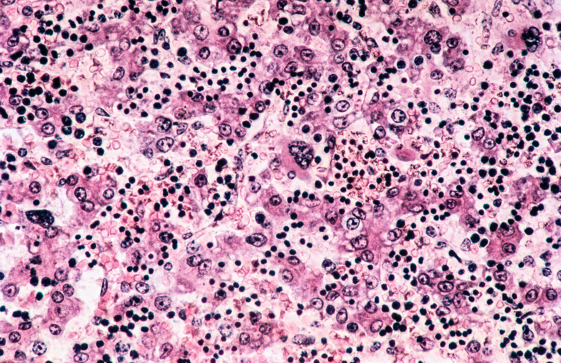Embryonic liver with haematopoiesis, LM