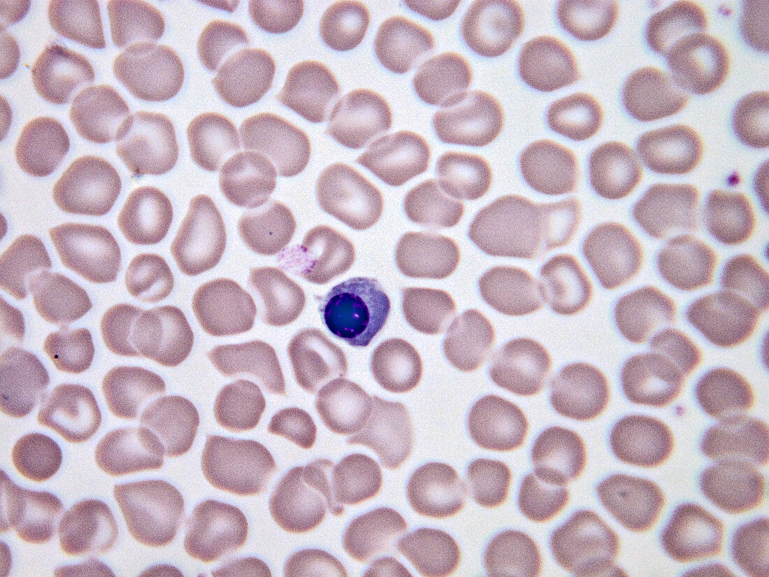 Nucleated red blood cells, LM