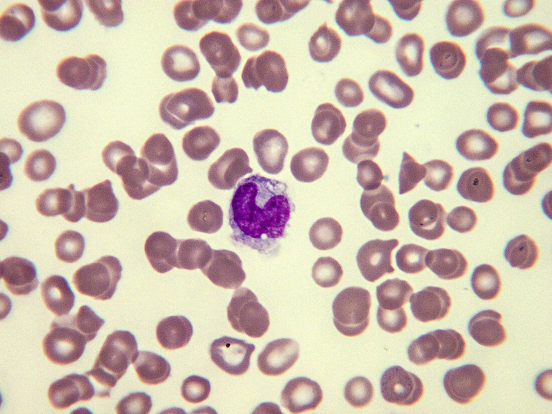 Normal myelocyte, LM