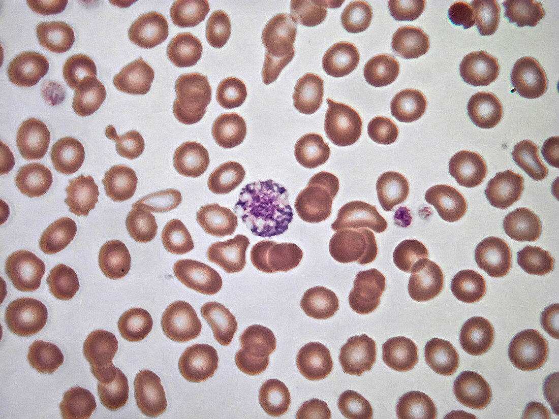 Giant platelet, LM
