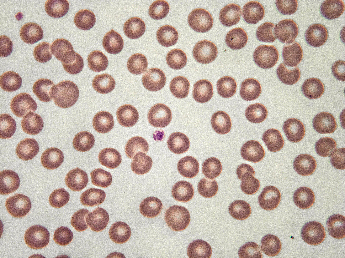 Platelets, LM