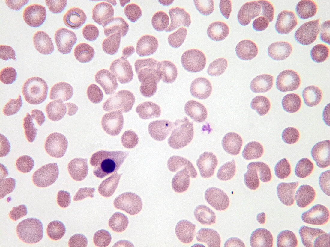 Nucleated red blood cells, LM
