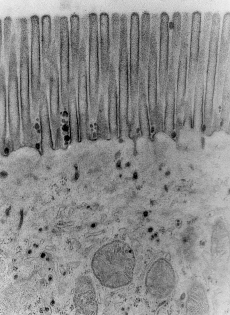 Brush Border of Epithelial Cell TEM