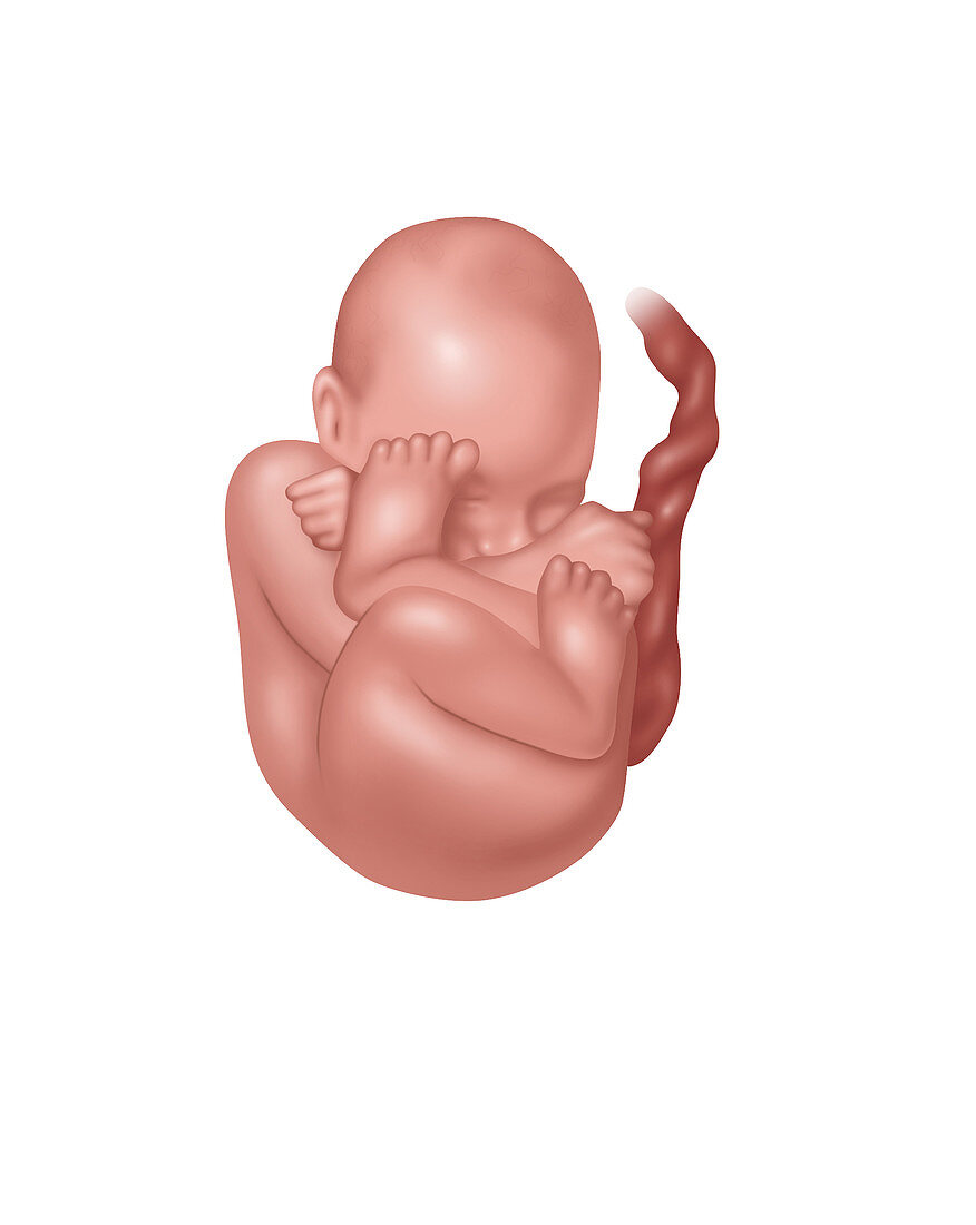 Fetus in Breech Position, Illustration