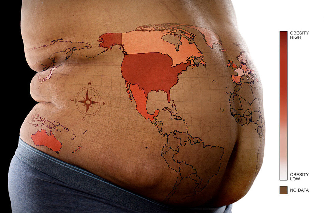 Global Obesity Rates