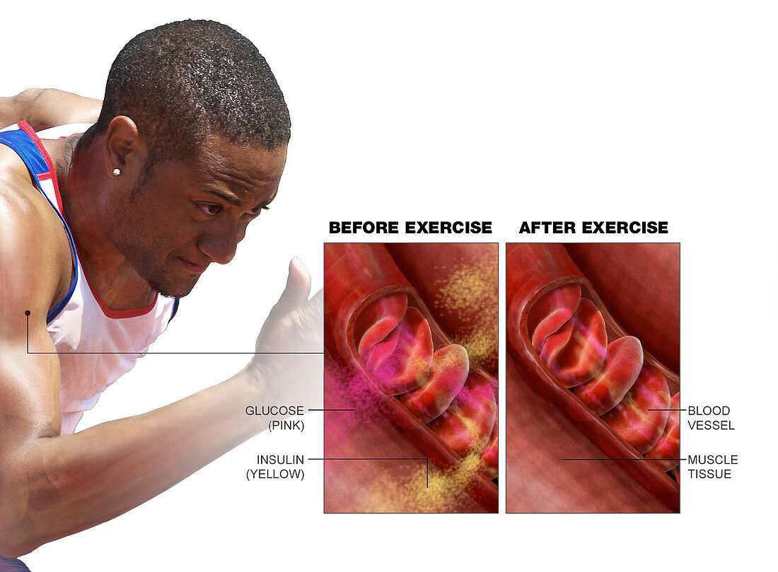 The Effects of Exercise on Glucose and Insulin Levels
