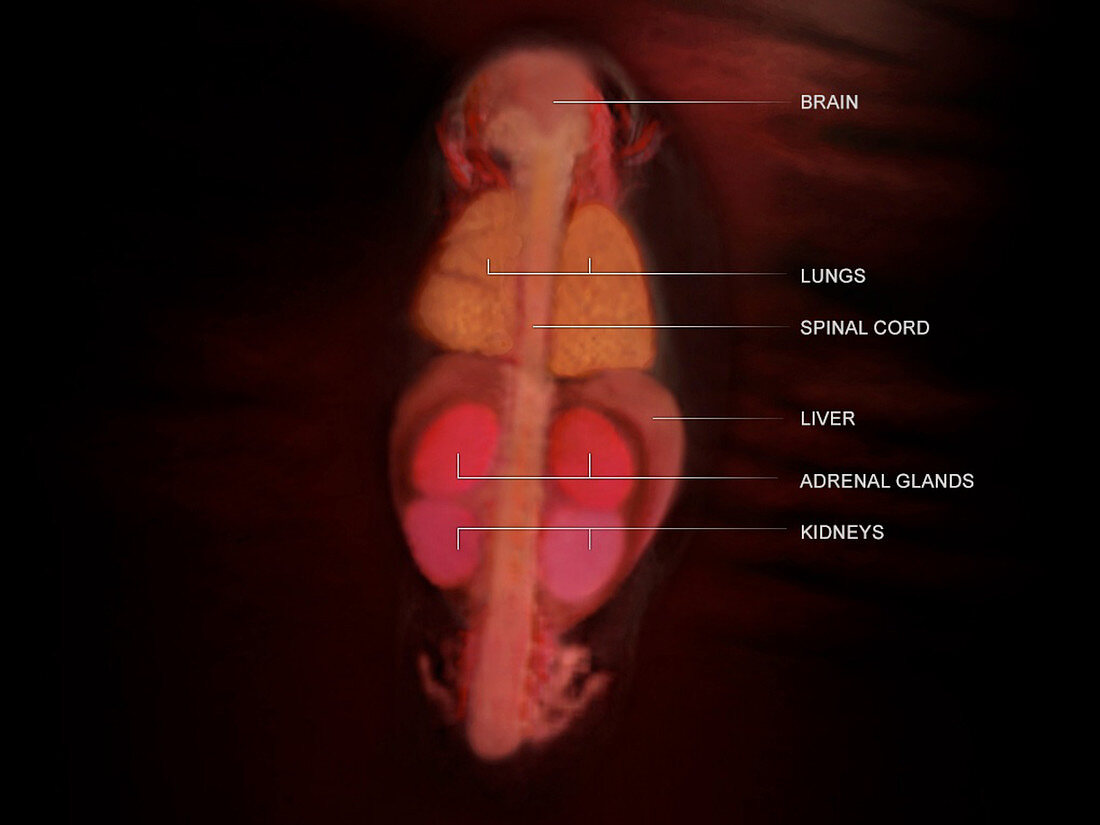 Posterior Fetus, Week 11