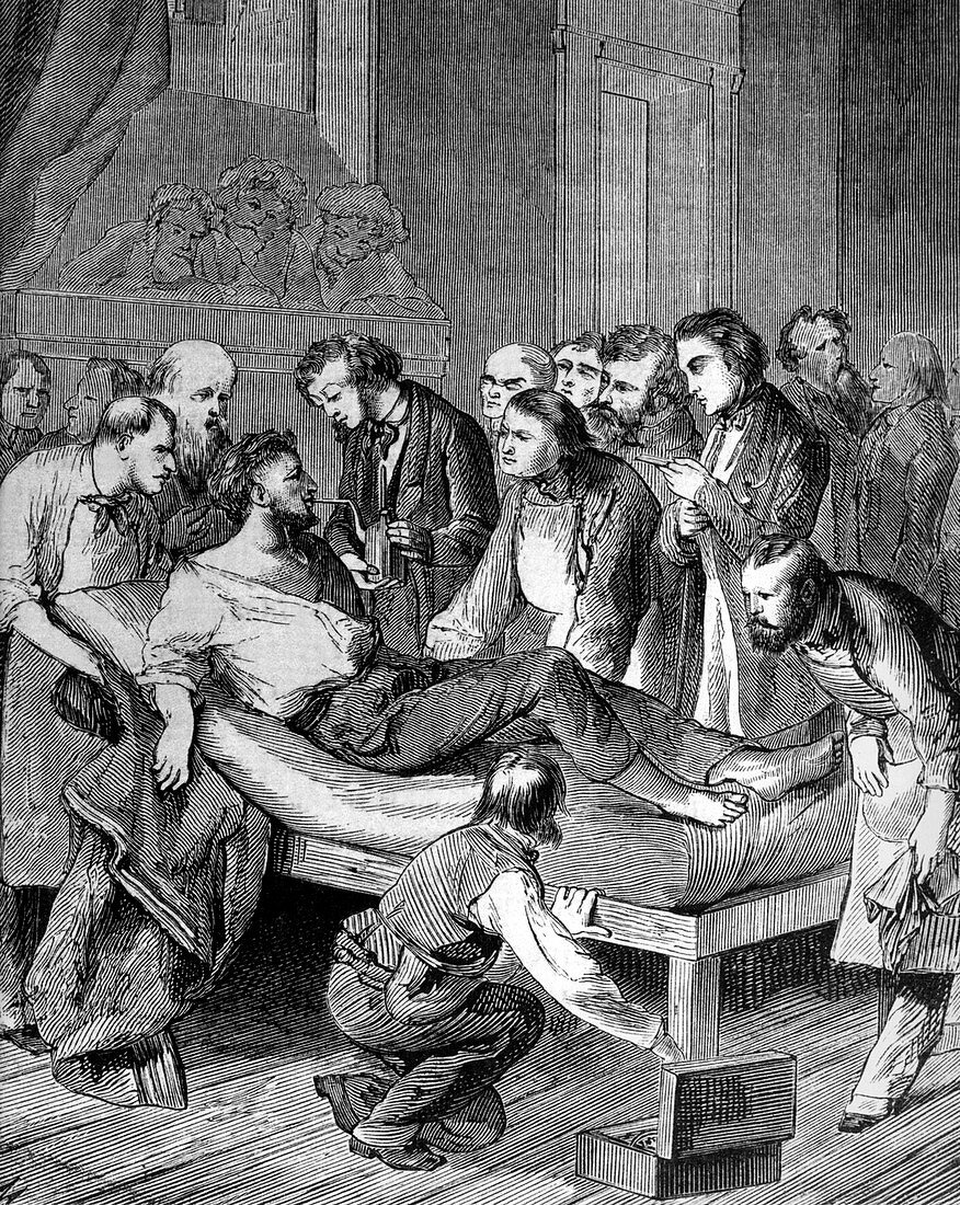 William Morton, First Use of Surgical Anesthesia, 1846
