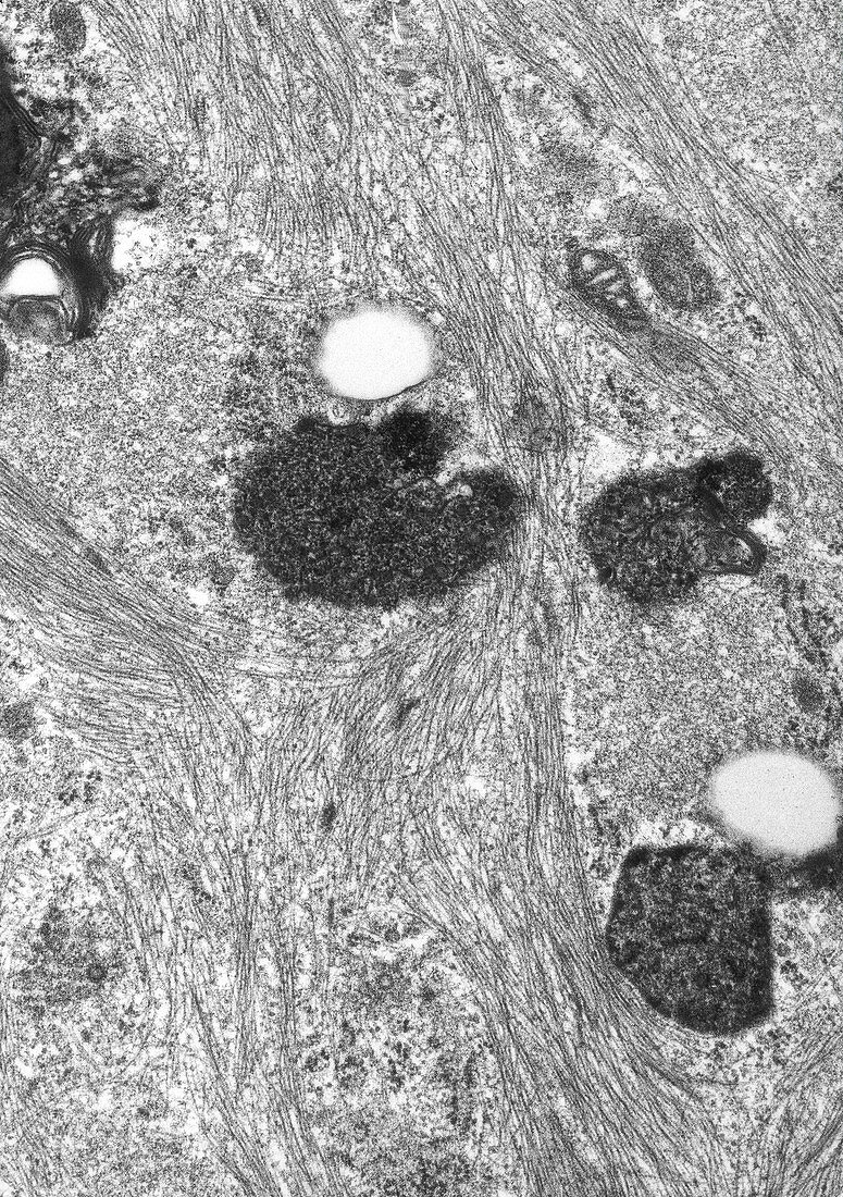 Sertoli Cell Cytoplasm Filaments TEM