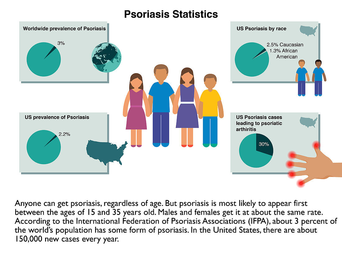 Psoriasis statistics, infographic