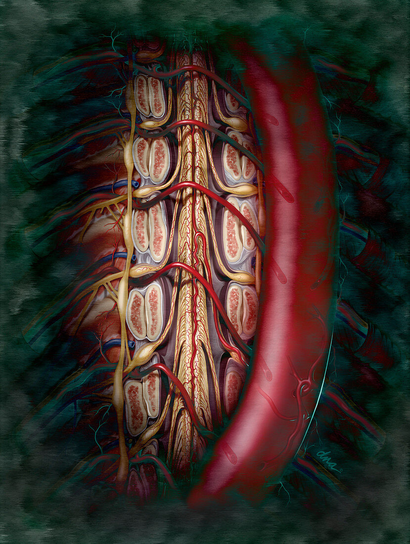 Artery of Adamkiewicz
