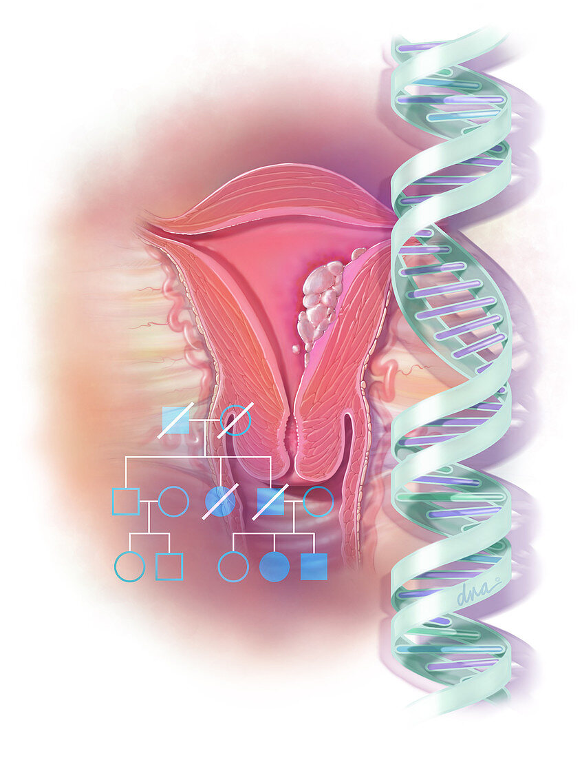 Genetic Screening with Gynaecological Cancers
