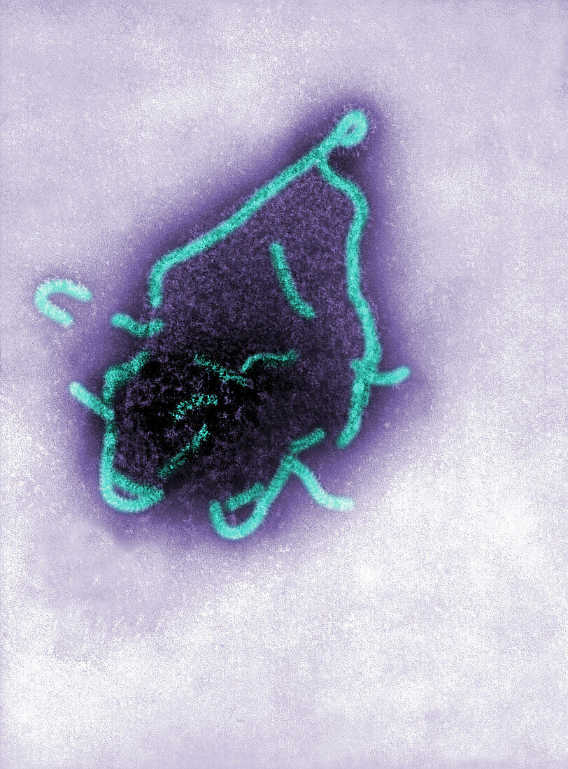 Human Parainfluenza Type 4A Virus, TEM