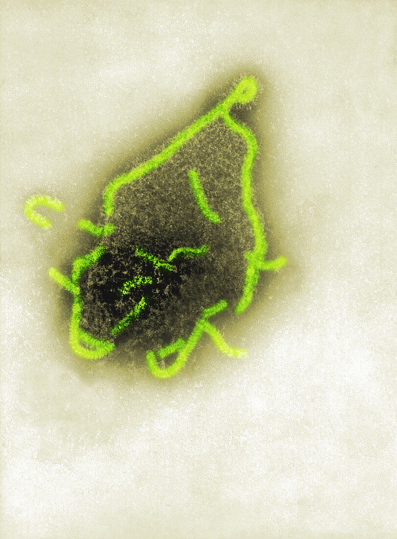 Human Parainfluenza Type 4A Virus, TEM