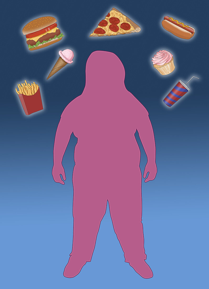 Obese Child and Junk Food, Illustration