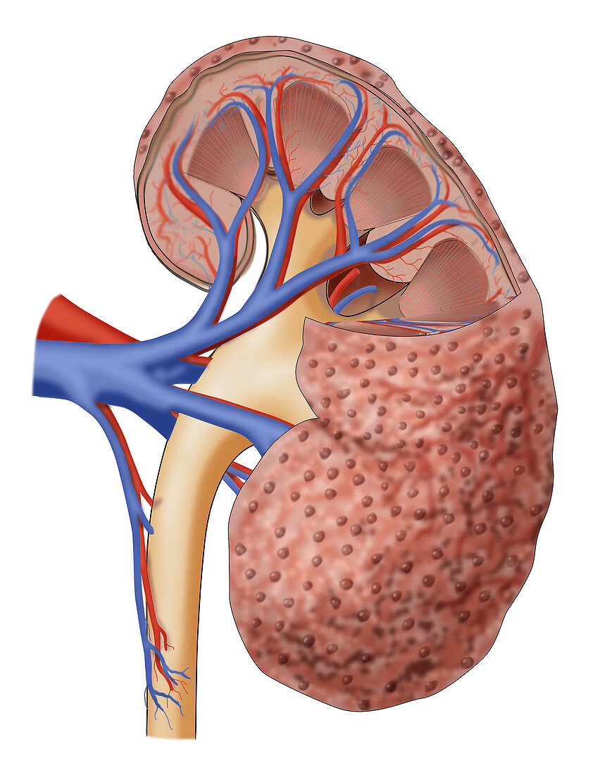 Chronic Kidney Disease, Illustration