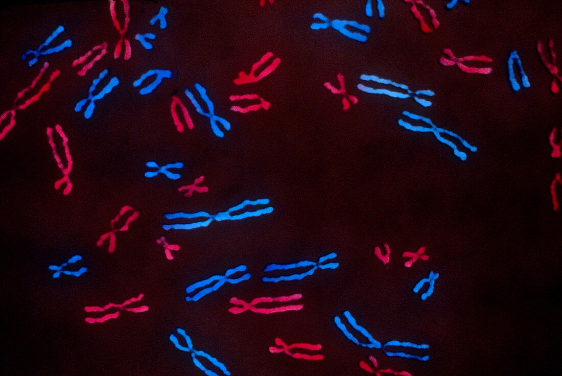 Metaphase Chromosomes