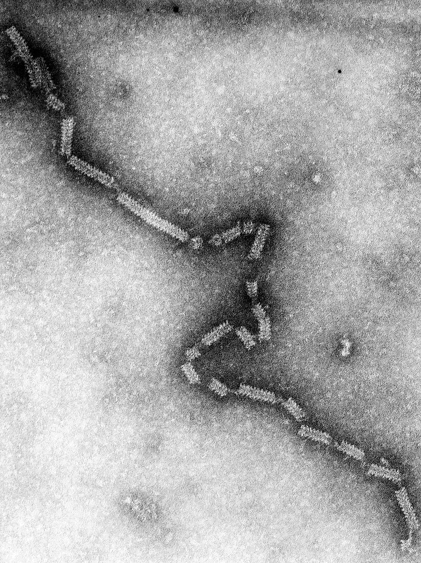 Human Parainfluenza Type 4A Virus, TEM