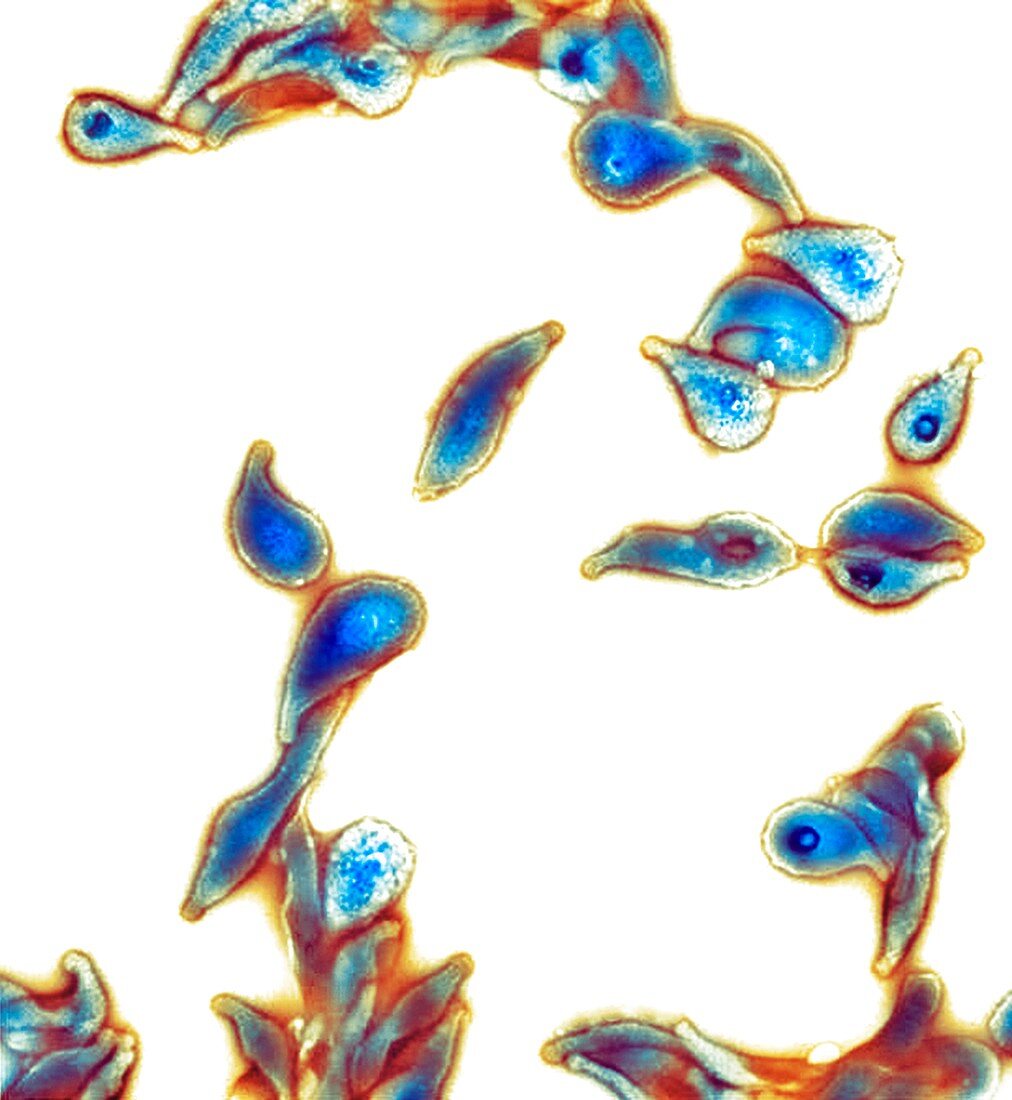Mycoplasma genitalium bacteria, TEM