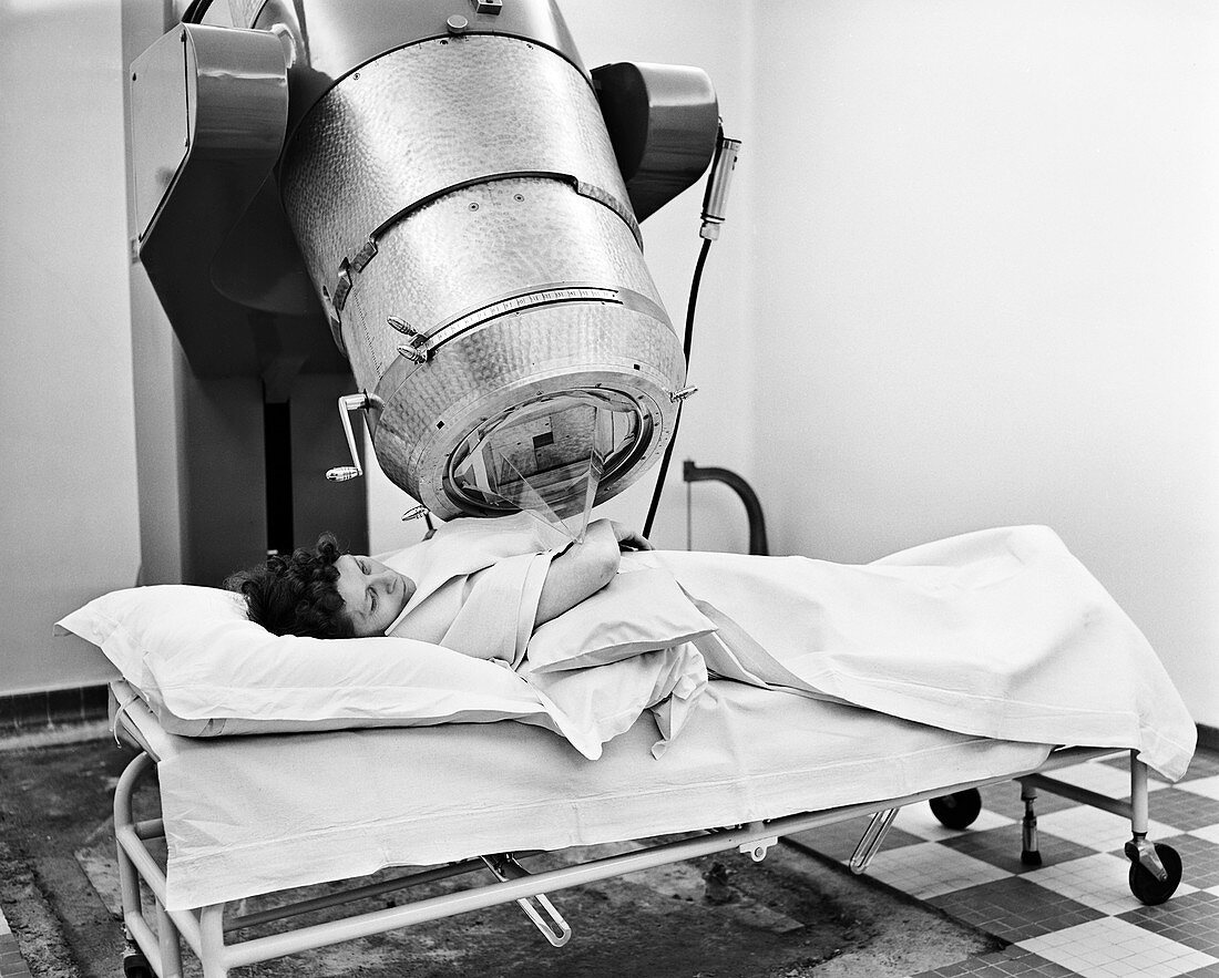 Cobalt radiotherapy treatment in France, 1950s
