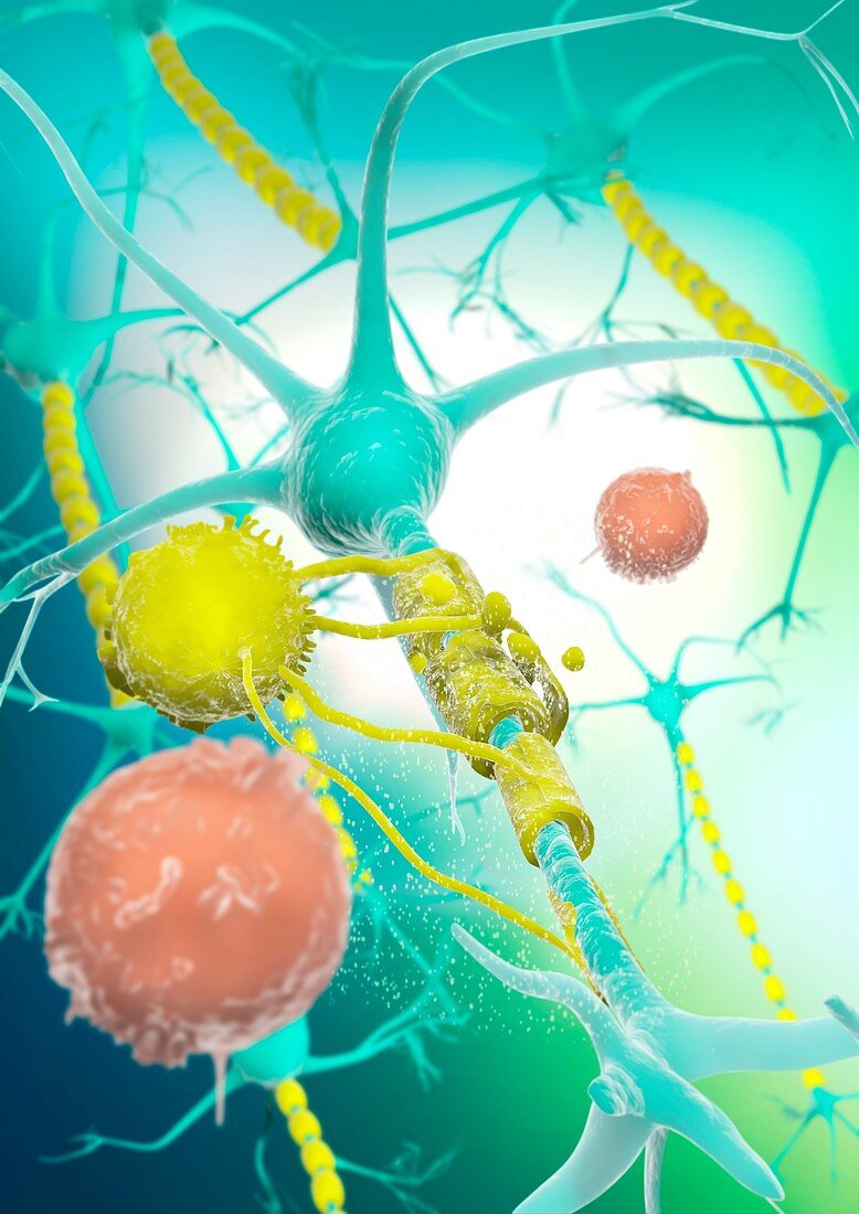 Lymphocytes attacking brain neuroglia, illustration