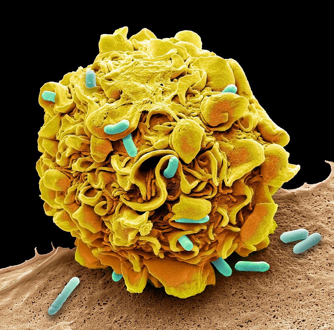 Macrophage engulfing e.coli bacteria, SEM