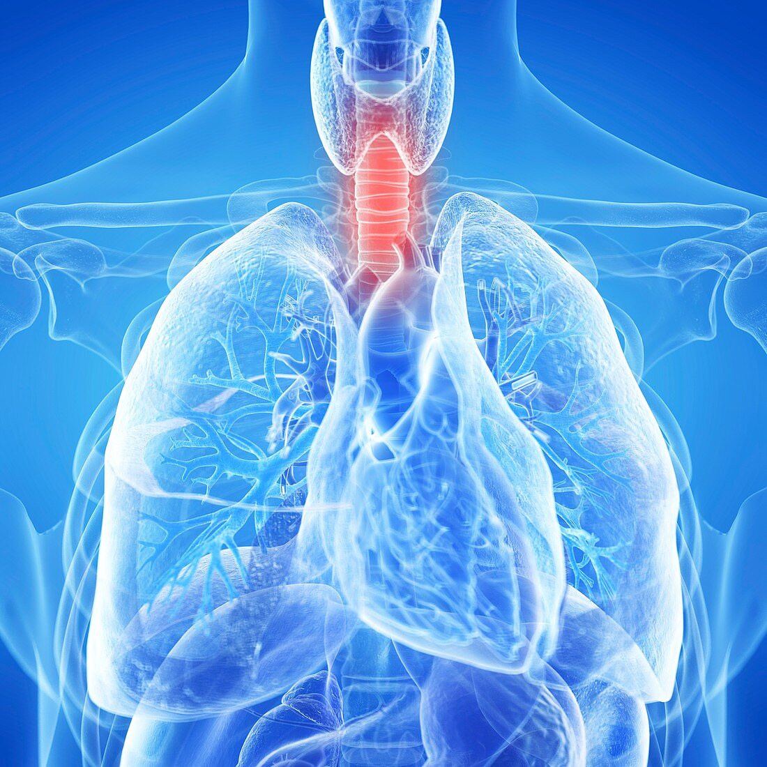 Illustration of an inflamed trachea