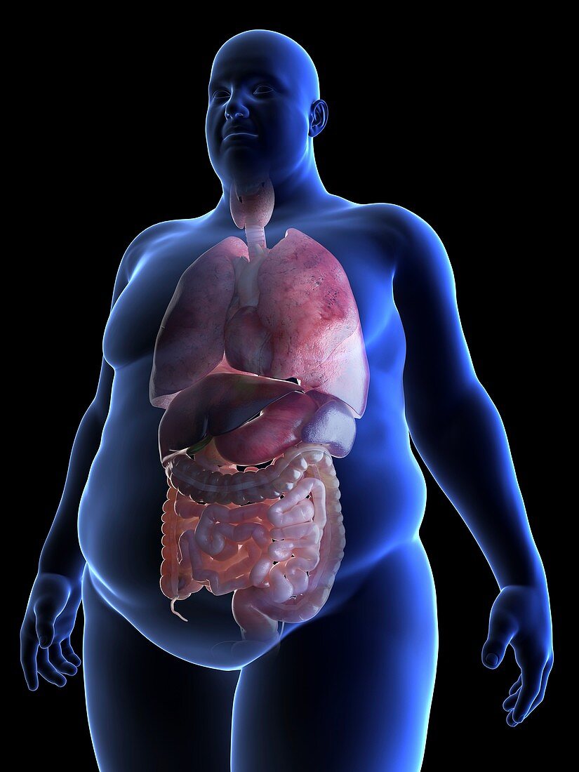 Illustration of an obese man's organs