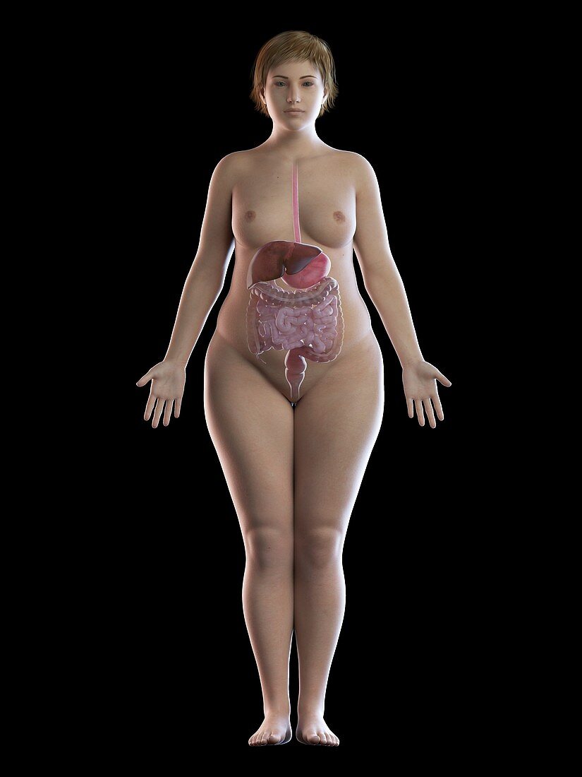 Illustration of an obese woman's digestive system