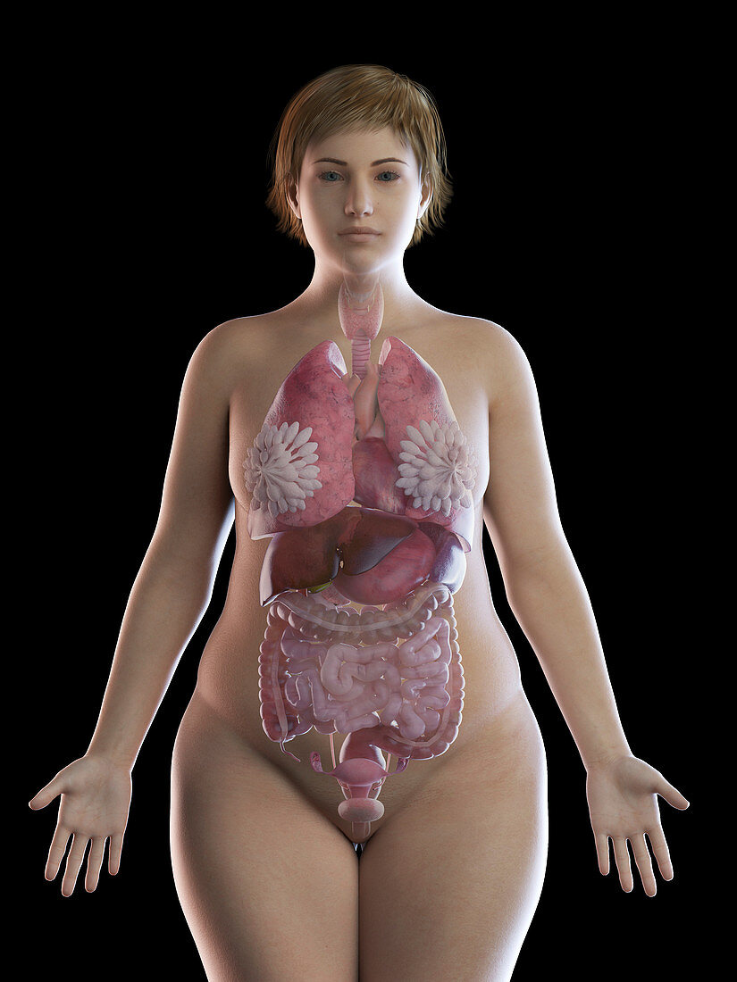 Illustration of an obese woman's organs