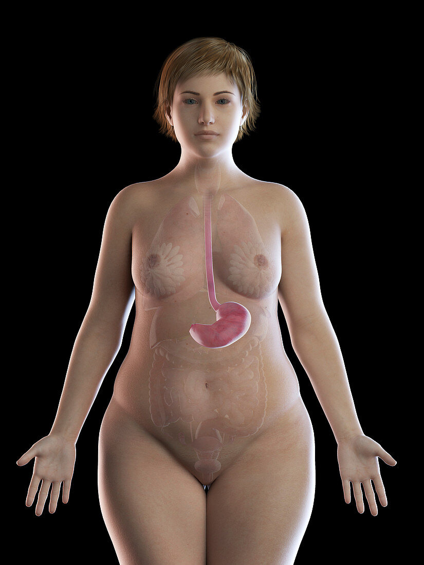 Illustration of an obese woman's stomach