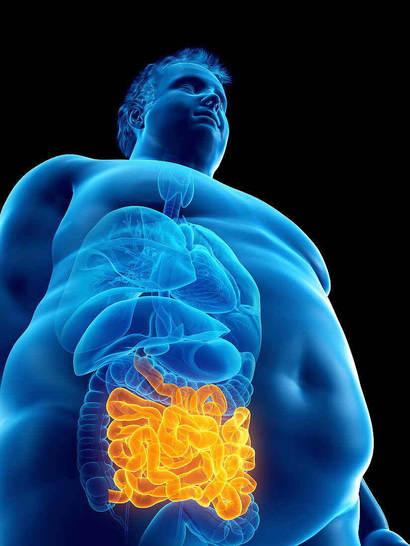 Illustration of an obese man's intestine