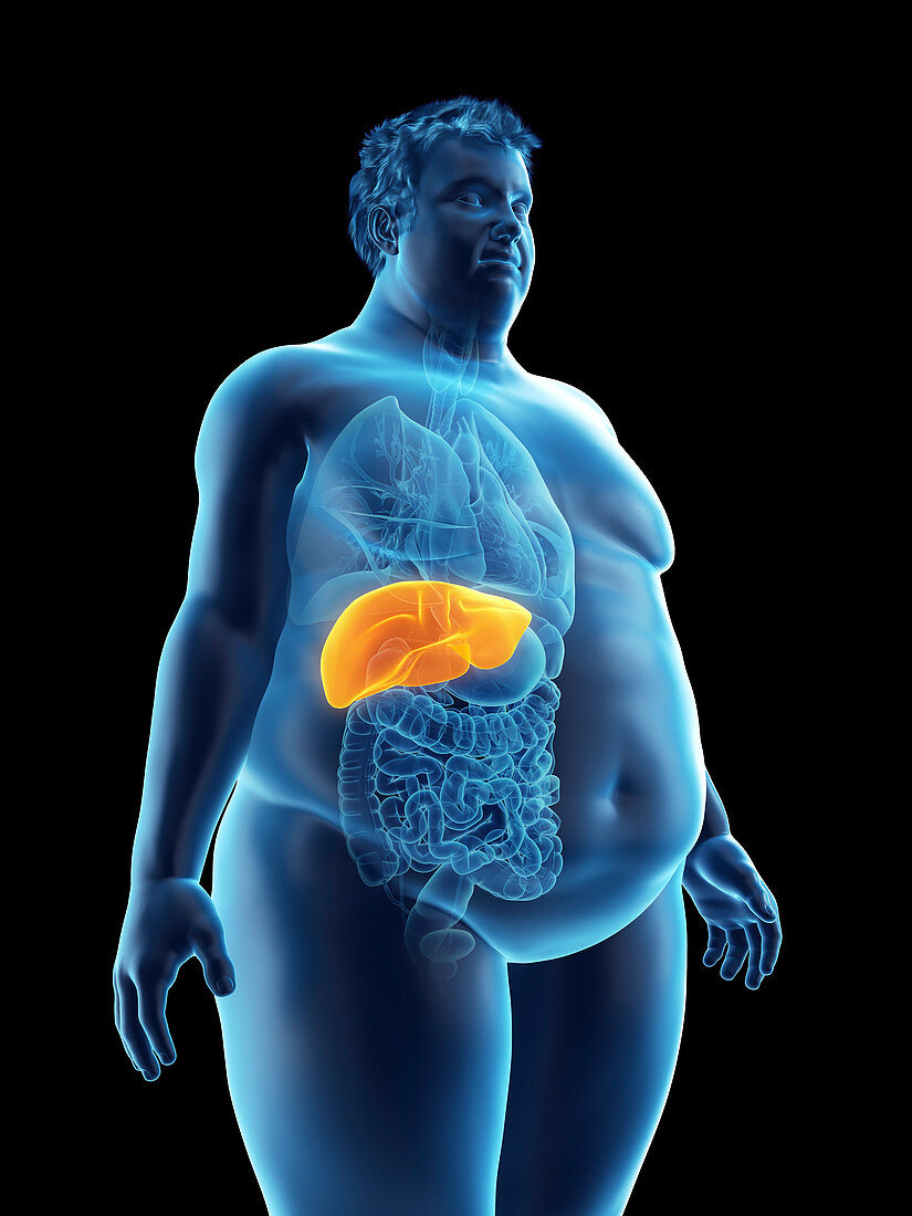 Illustration of an obese man's liver