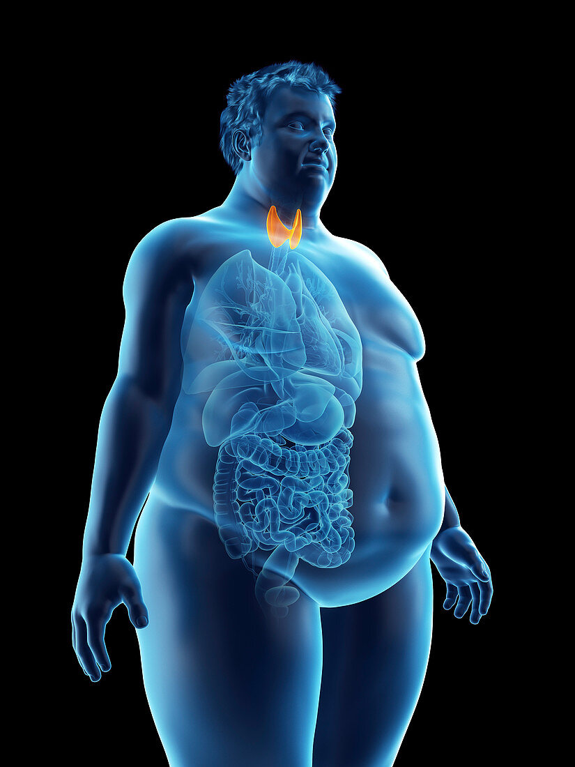 Illustration of an obese man's thyroid gland